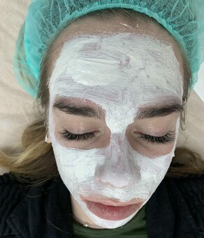 Маски для лица в студии косметологии «LaEsthetics» в Киеве. Записаться на процедуры со скидкой.