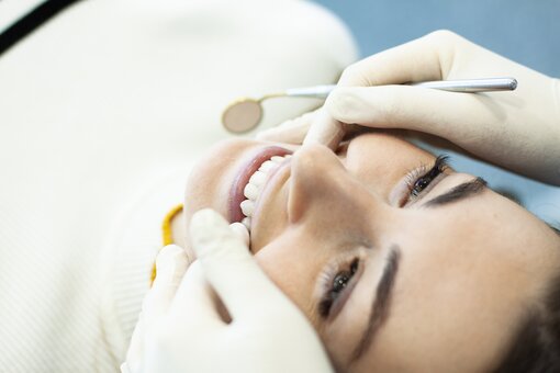 Teeth whitening in dentistry "Bella Vista" Kharkiv. Make an appointment with a dentist with a discount