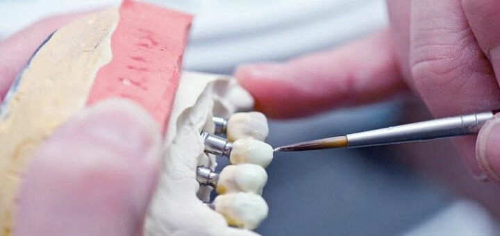 Dental treatment