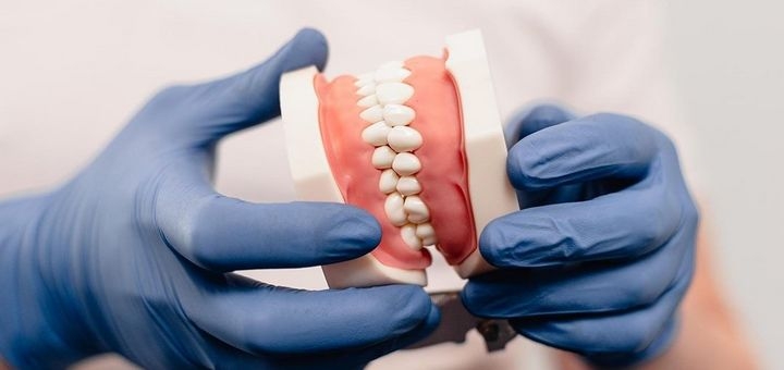 Лечение и протезирование зубов в «Dr. Samsonov dental clinic» в Харькове. Записаться на прием стоматолога со скидкой.