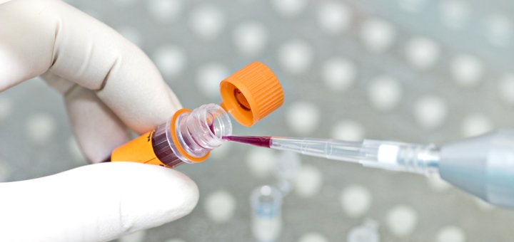 Комплексні аналізи в мережі медичних лабораторій «Нова діагностика» в Києві 4